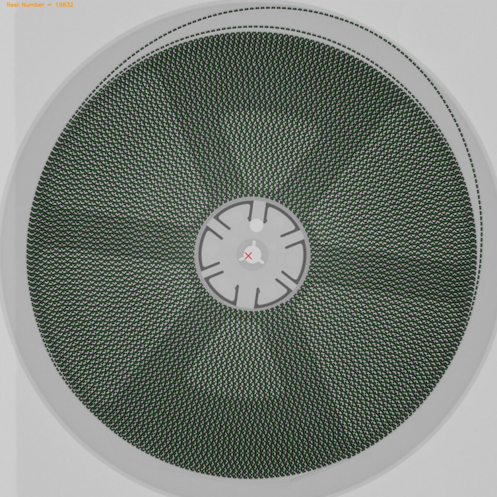 Neotel Xray Counter result